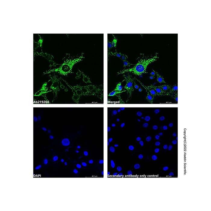Hsp60 Mouse mAb (Biotin) -    by Aladdin Scientific