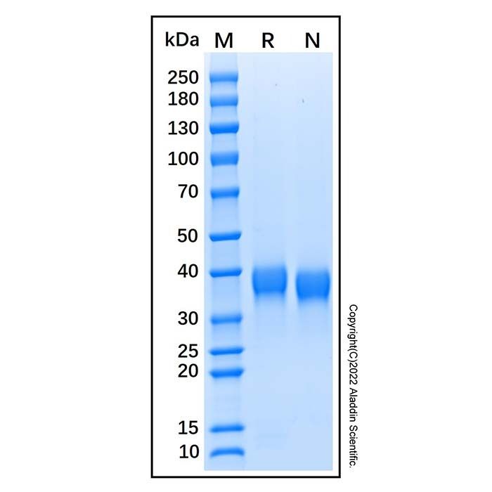 Recombinant Human Azurocidin/CAP37/HBP Protein -    by Aladdin Scientific
