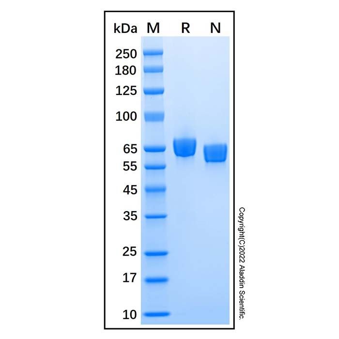 Recombinant Human EphA7 Protein -    by Aladdin Scientific