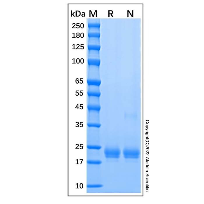 Recombinant Human IL-1 alpha/IL-1F1 Protein -    by Aladdin Scientific