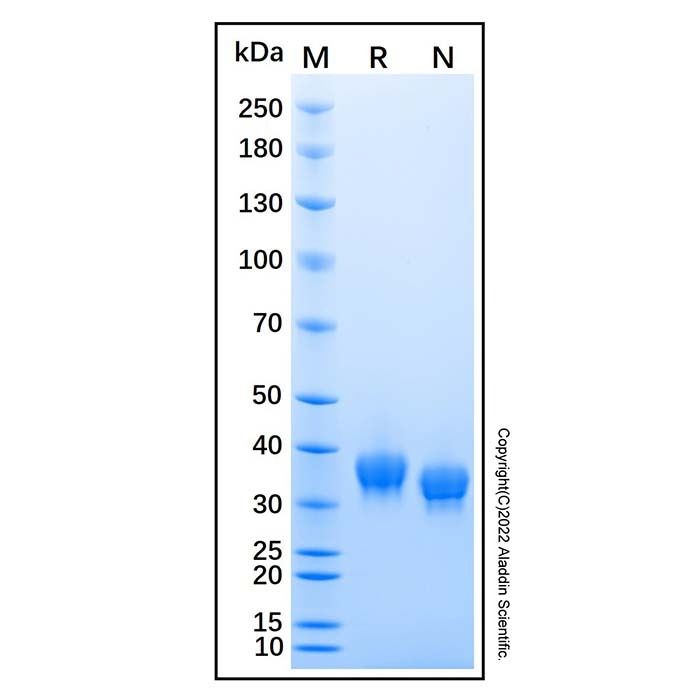 Recombinant Human JAM-B/VE-JAM Protein -    by Aladdin Scientific