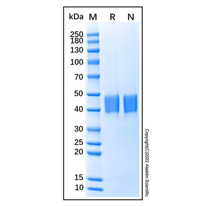 Recombinant Human LRG1 Protein -    by Aladdin Scientific