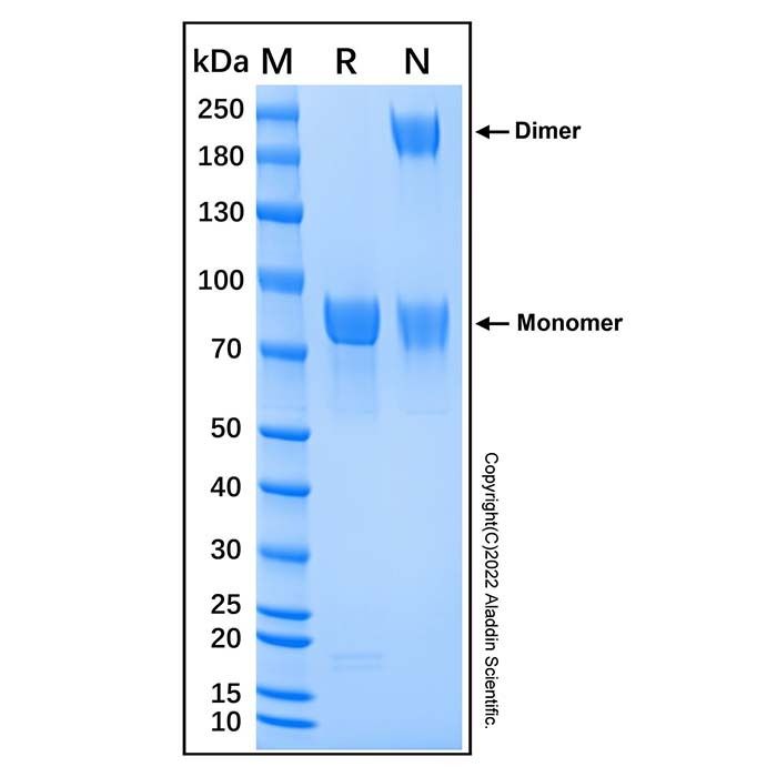 Recombinant Human Meprin beta Subunit/MEP1B Protein -    by Aladdin Scientific