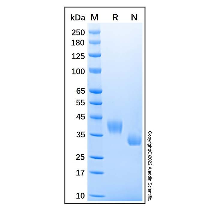 Recombinant Human Prostasin/Prss8 Protein -    by Aladdin Scientific
