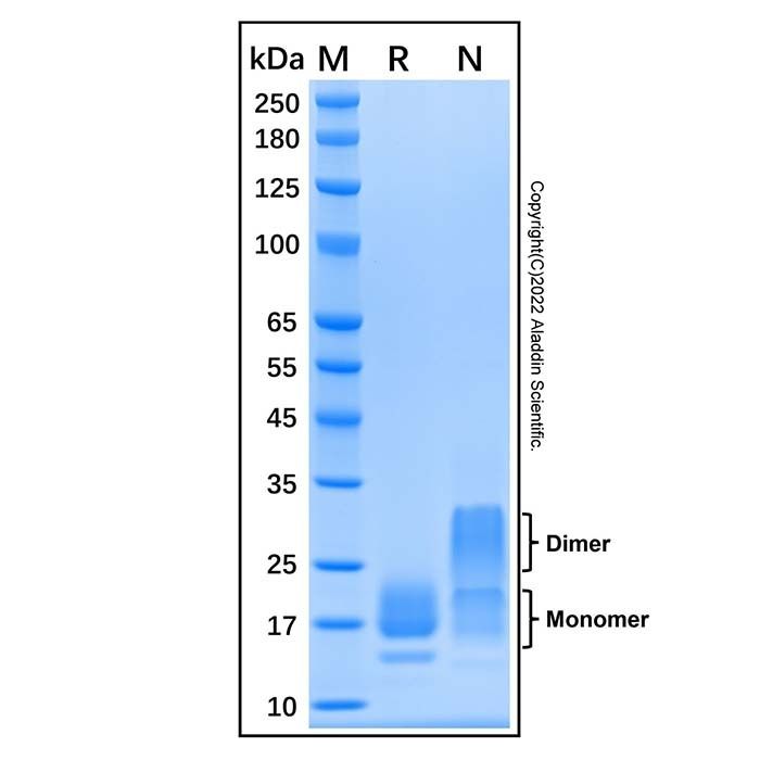 Recombinant Human TFF2 Protein -    by Aladdin Scientific