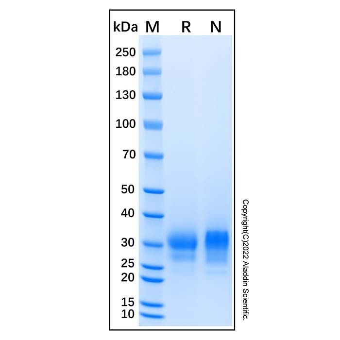 Recombinant Human TFPI-2 Protein -    by Aladdin Scientific