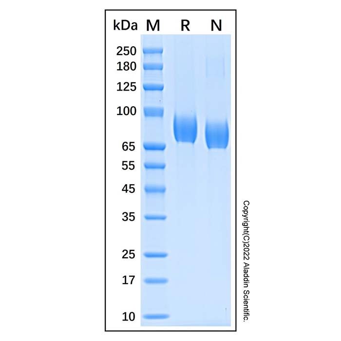 Recombinant Human Vasorin/SLIT-like 2 Protein -    by Aladdin Scientific