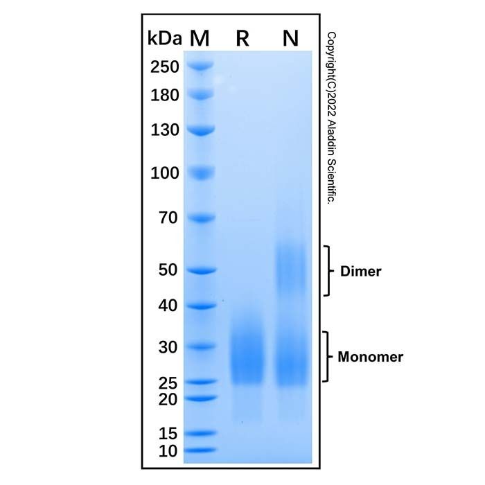 Recombinant Mouse CD90/Thy1 Protein -    by Aladdin Scientific