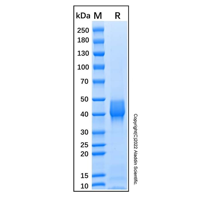 Recombinant Mouse Follistatin-like 1 Protein -    by Aladdin Scientific