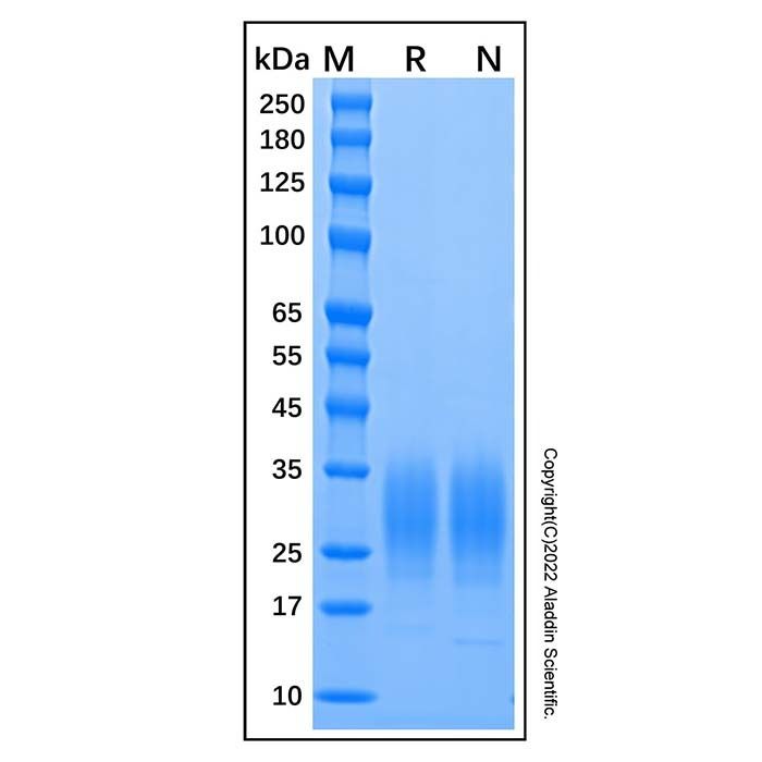 Recombinant Mouse IL-22 Protein -    by Aladdin Scientific