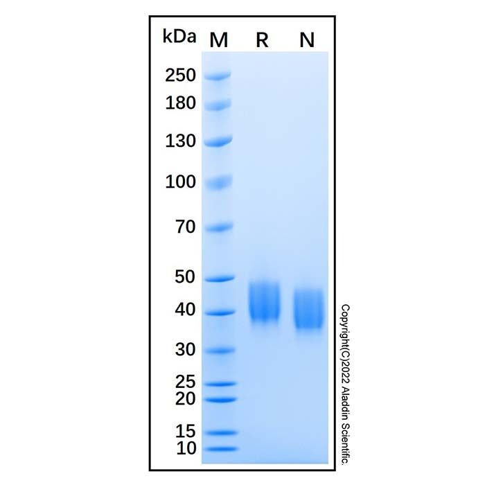 Recombinant Mouse Mesothelin Protein -    by Aladdin Scientific