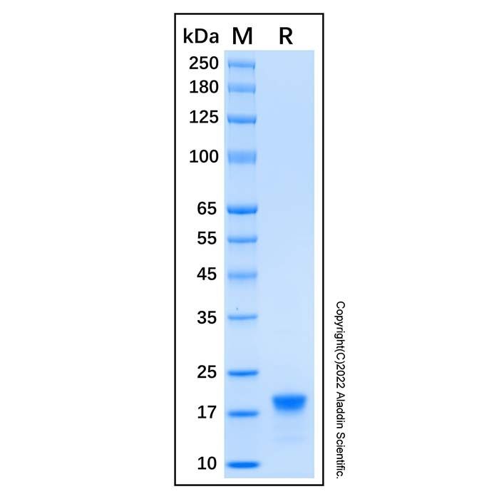 Recombinant Human CD20 Protein -    by Aladdin Scientific
