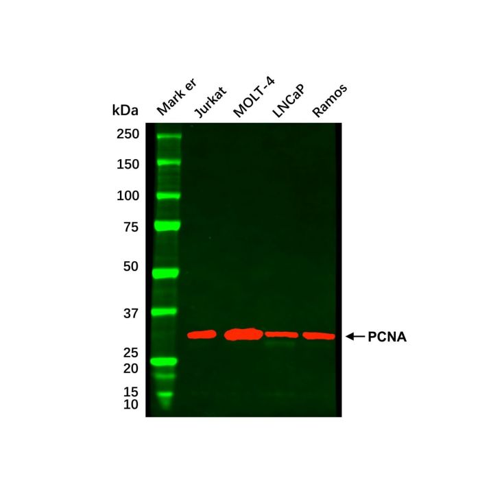 Jurkat Whole Cell Lysate -    by Aladdin Scientific