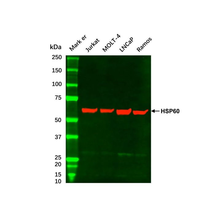 MOLT-4 Whole Cell Lysate -    by Aladdin Scientific