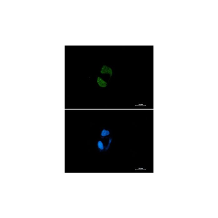 Recombinant Argonaute-2 Antibody -    by Aladdin Scientific