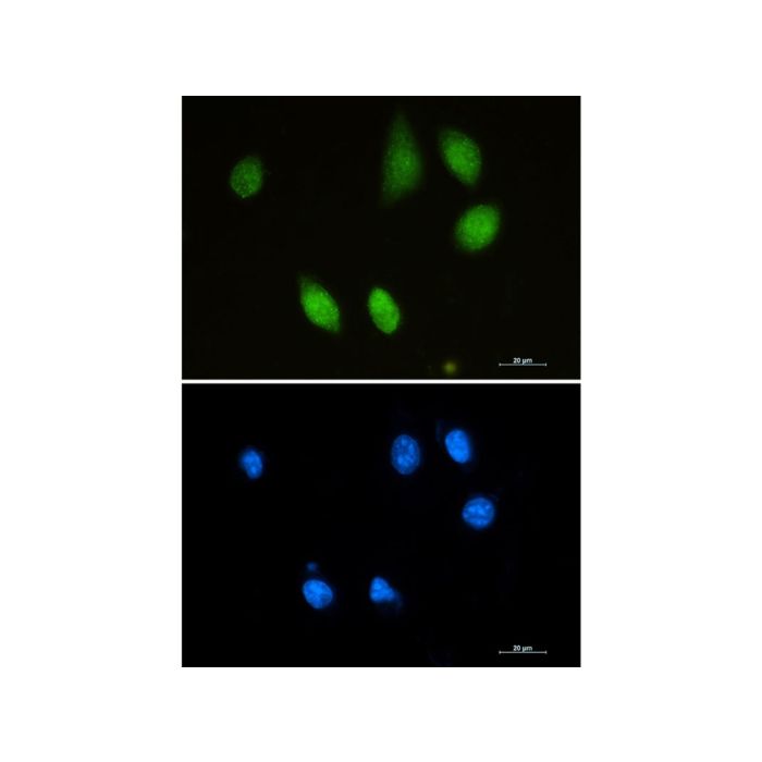 Recombinant Choline Acetyltransferase Antibody - Primary antibody   by Aladdin Scientific