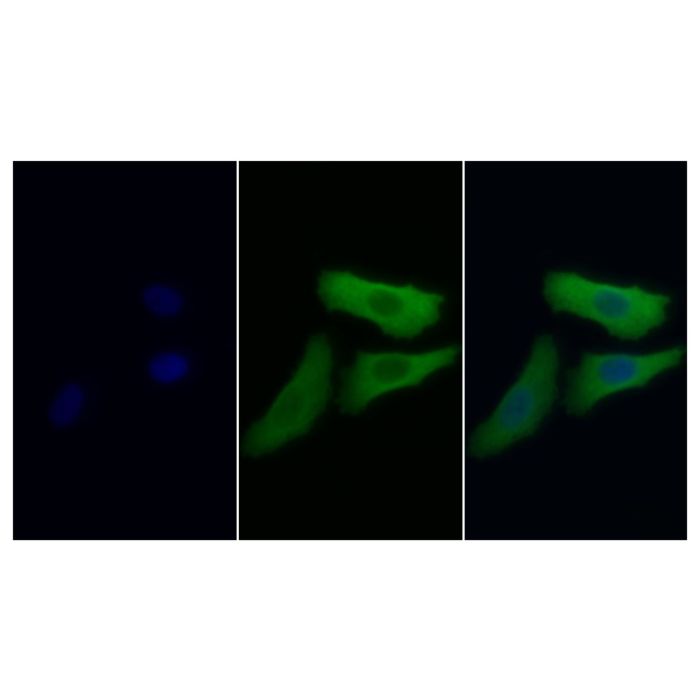 NSE Mouse mAb -    by Aladdin Scientific
