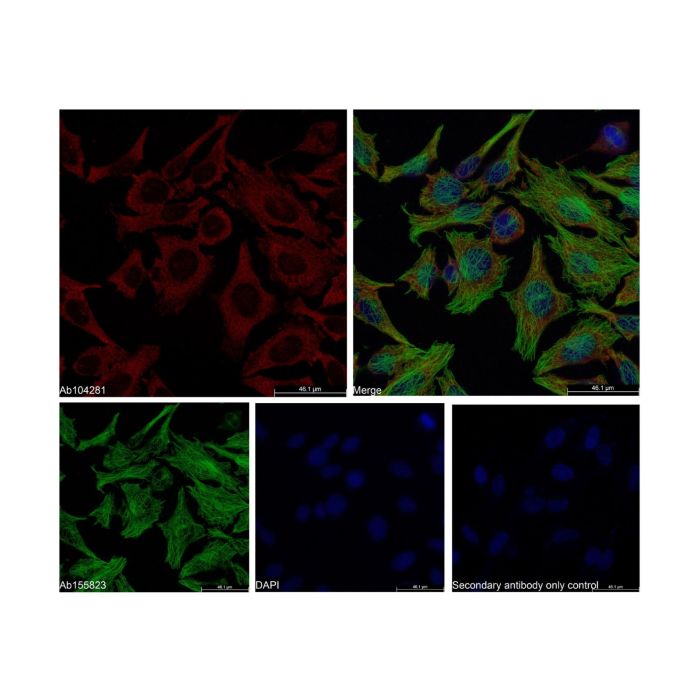 Donkey Anti-Rabbit IgG H&L (AF647) - by Aladdin Scientific