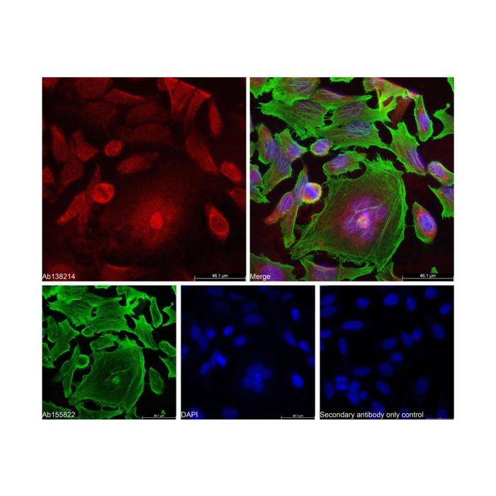 Goat Anti-Rabbit IgG H&L (AF594) - by Aladdin Scientific