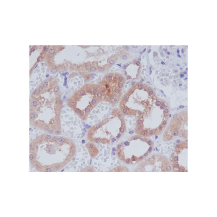 Recombinant AMPK alpha 1 Antibody -    by Aladdin Scientific