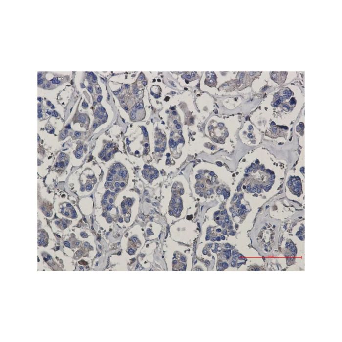 Recombinant ARPC5/p16 ARC Antibody -    by Aladdin Scientific