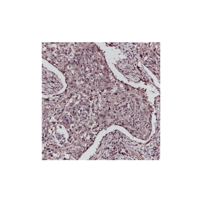 Recombinant ERK1 Antibody - Primary antibody by Aladdin Scientific