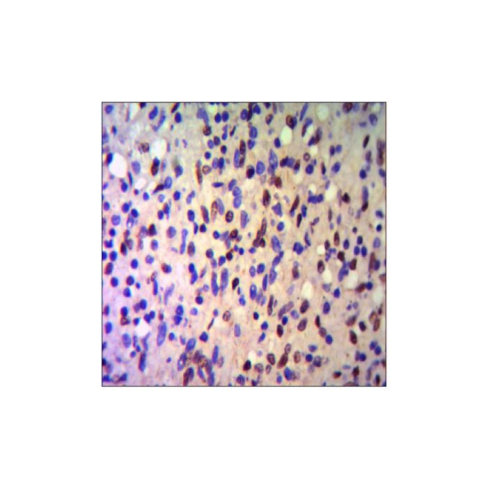 KAP1 Mouse mAb -    by Aladdin Scientific