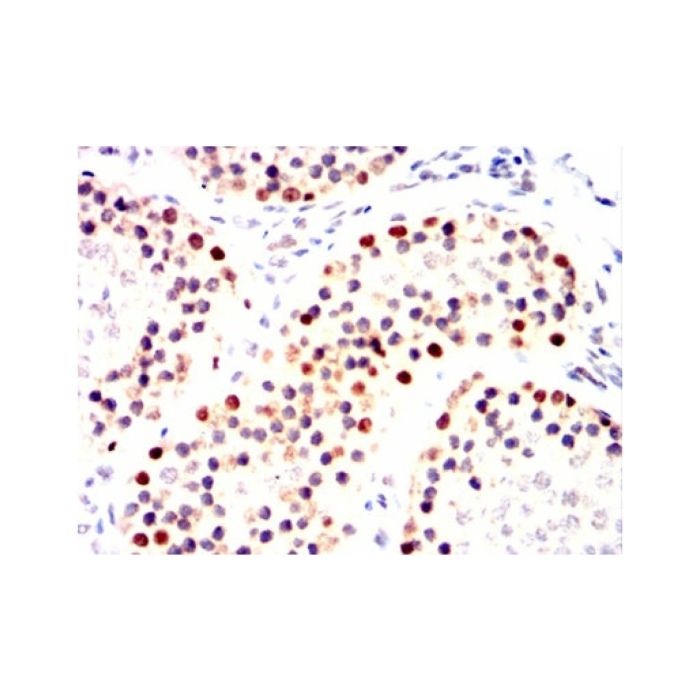 Mre11 Mouse mAb -    by Aladdin Scientific