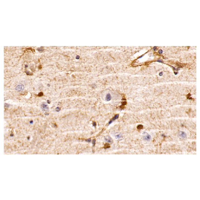PTEN Mouse mAb -    by Aladdin Scientific