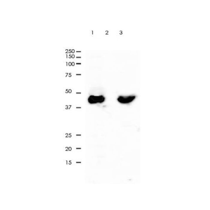 Recombinant Cytokeratin 20 Antibody - by Aladdin Scientific