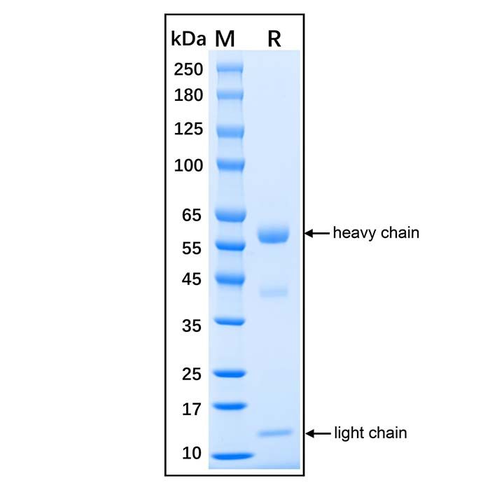Native Human Myeloperoxidase Protein -    by Aladdin Scientific