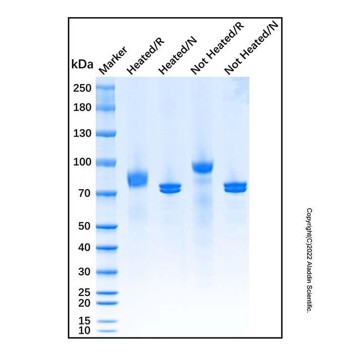 Plasminogen from human plasma -   CAS No(9001-91-6) by Aladdin Scientific