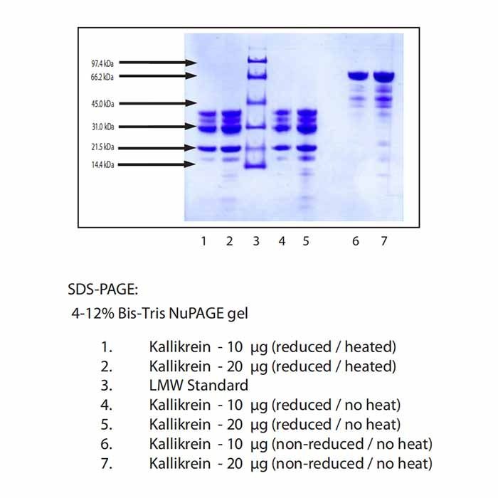 Kallikrein from Human Plasma -   CAS No(9001-01-8) by Aladdin Scientific