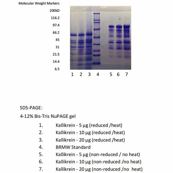 Kallikrein, Cynomolgus Monkey Plasma -    by Aladdin Scientific