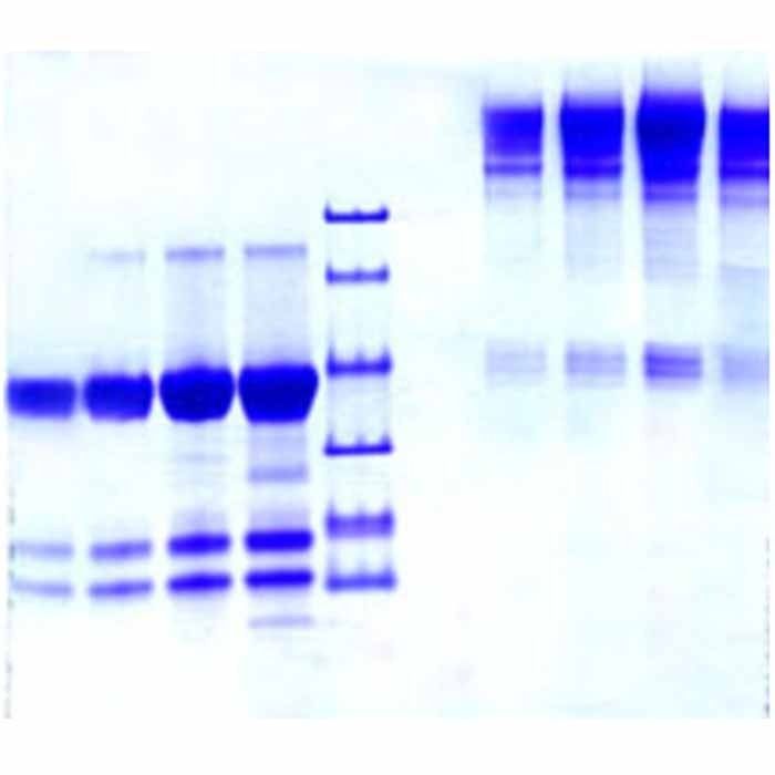 Immunoglobulin M, Fc5mu, Human Plasma -    by Aladdin Scientific