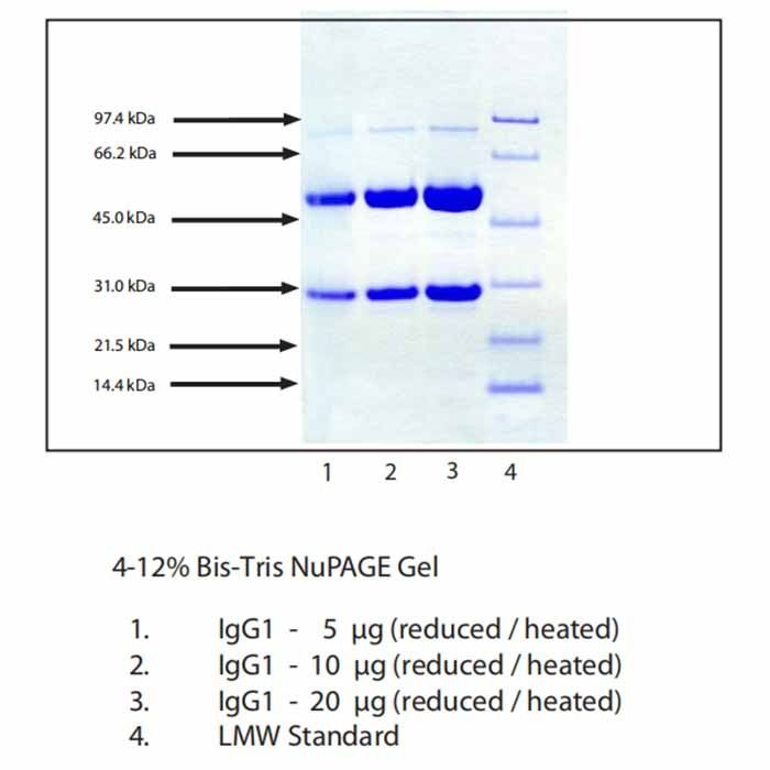 Immunoglobulin G1 (IgG1), Normal Human Plasma -    by Aladdin Scientific