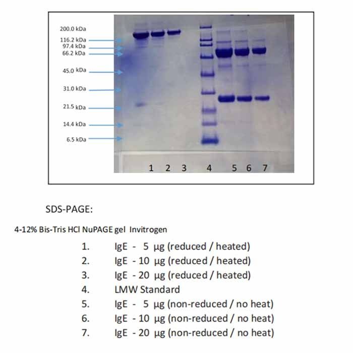 Immunoglobulin E (IgE), Human Myeloma Plasma, Lambda -    by Aladdin Scientific