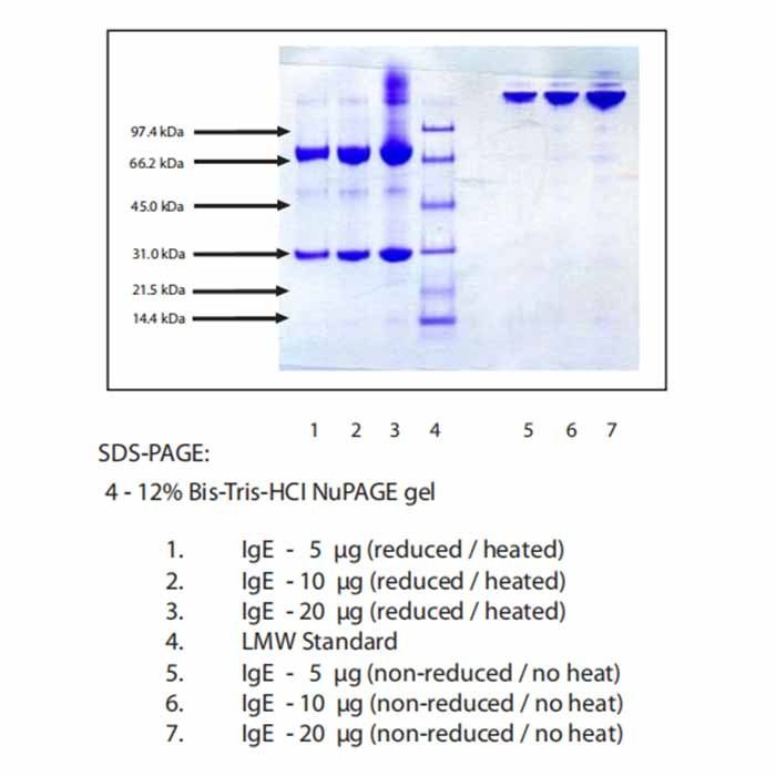Immunoglobulin E (IgE), Human Myeloma Plasma, Kappa -    by Aladdin Scientific