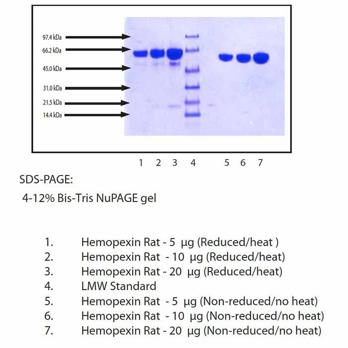 Hemopexin, Rat Serum -    by Aladdin Scientific