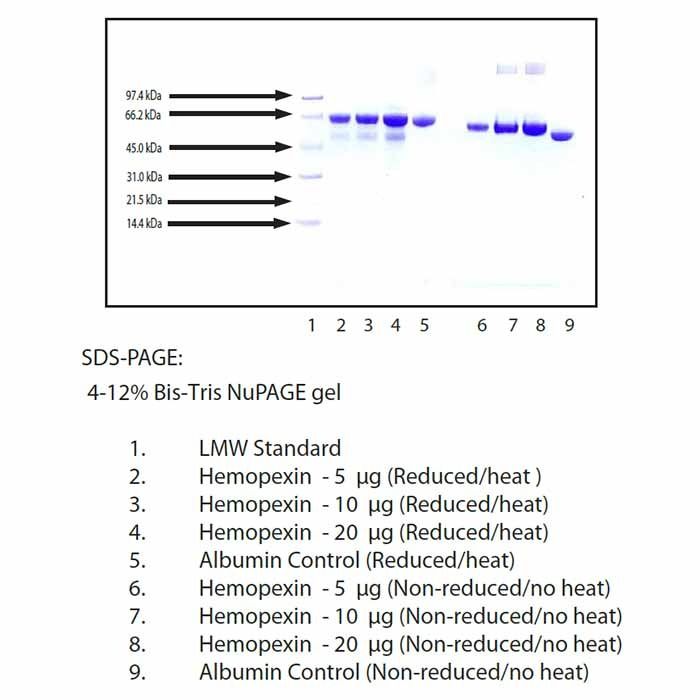 Hemopexin from Human Plasma -   CAS No(9013-71-2) by Aladdin Scientific