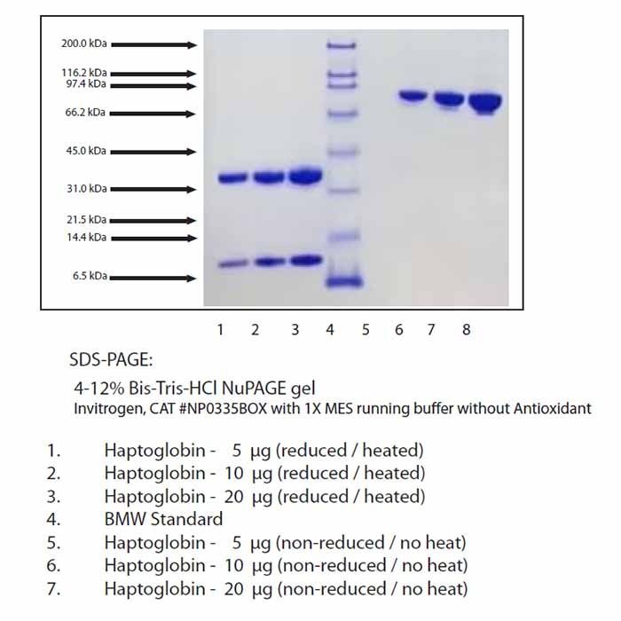 Haptoglobin, Rat Serum -    by Aladdin Scientific