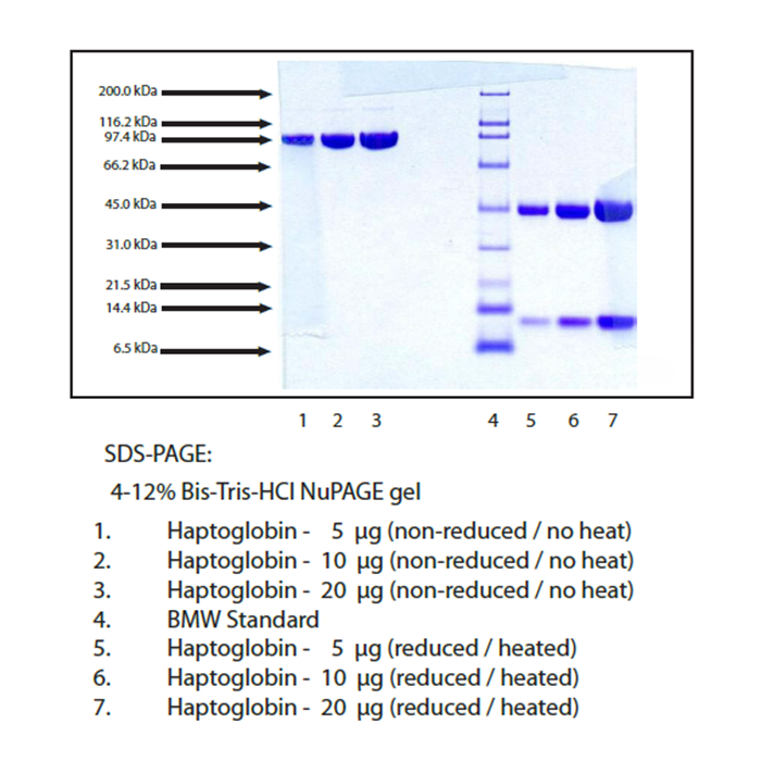 Haptoglobin, Phenotype 1-1, Human Plasma -    by Aladdin Scientific