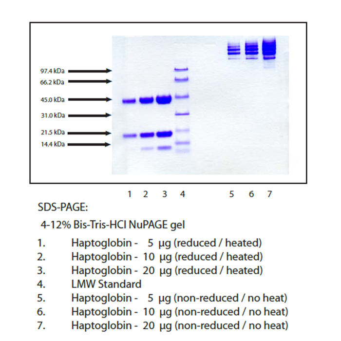 Haptoglobin from human plasma -   CAS No(9087-69-8) by Aladdin Scientific