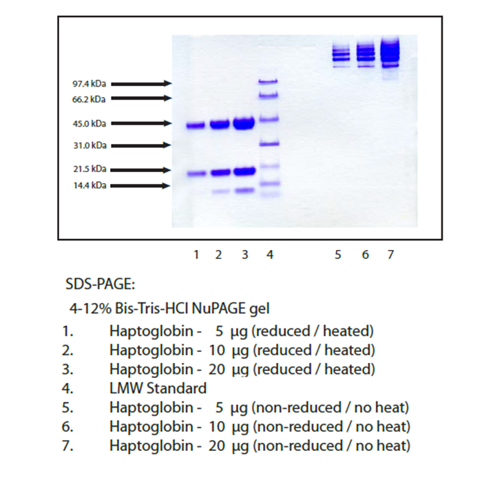Haptoglobin, Mixed Type from Human Plasma -   CAS No(9087-69-8) by Aladdin Scientific