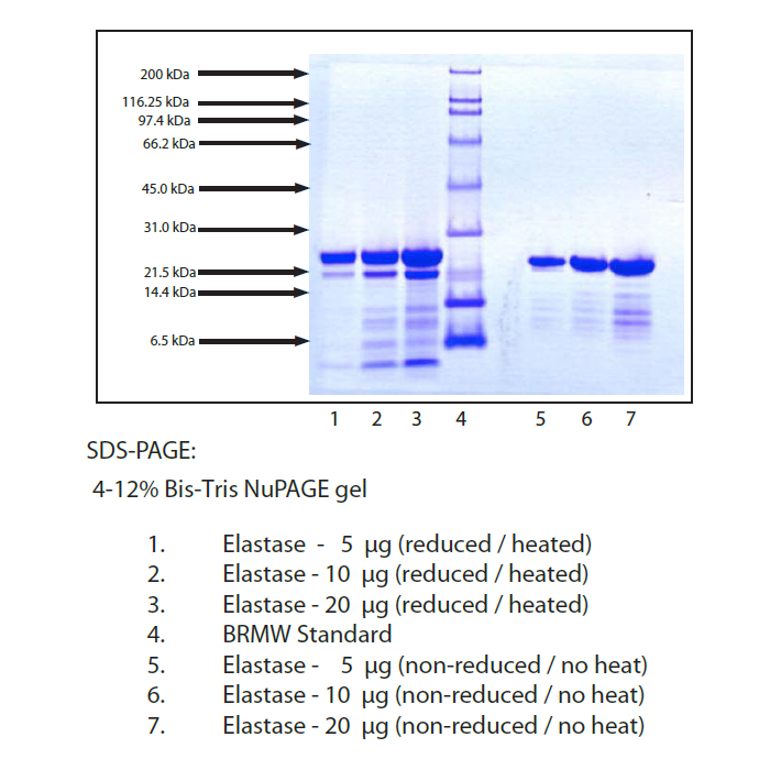 Elastase, Porcine Pancreas -    by Aladdin Scientific