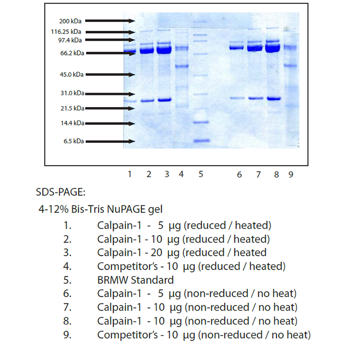 Calpain-1, Porcine Erythrocytes -    by Aladdin Scientific