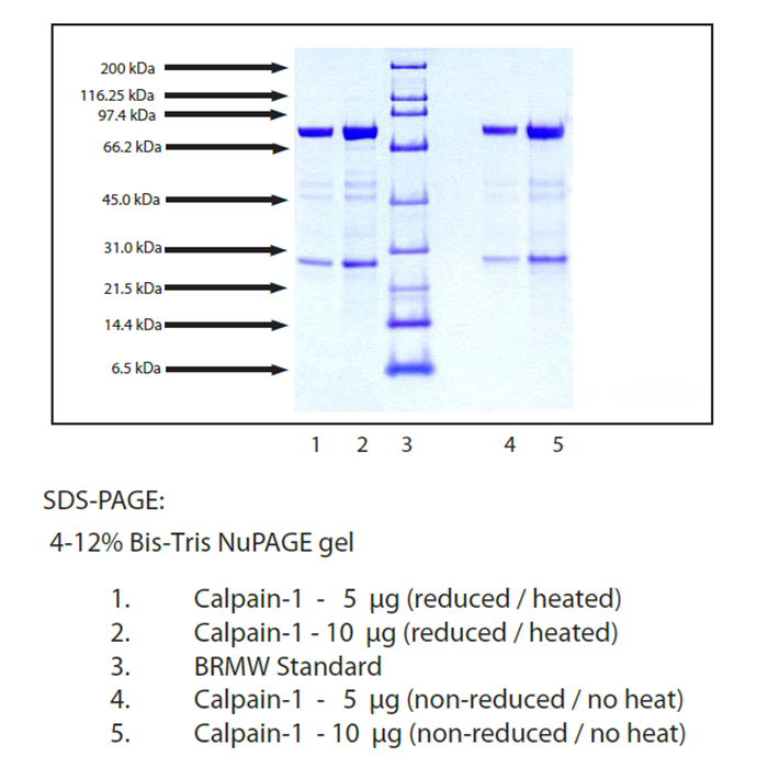 Calpain-1 from Human Erythrocyte -    by Aladdin Scientific