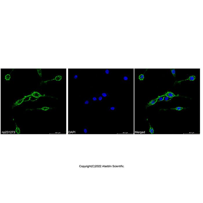 Concanavalin A, AF488 conjugate -   CAS No(11028-71-0) by Aladdin Scientific