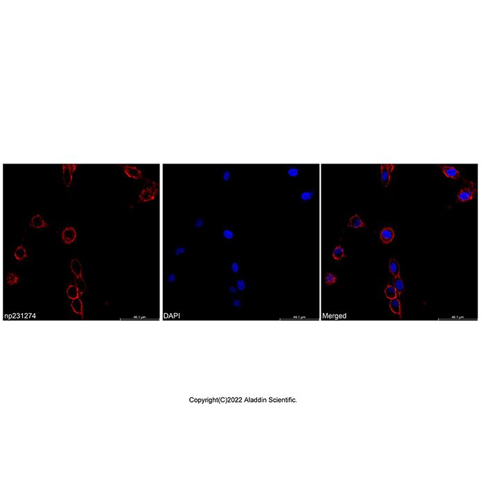Concanavalin A, AF594 conjugate -   CAS No(11028-71-0) by Aladdin Scientific