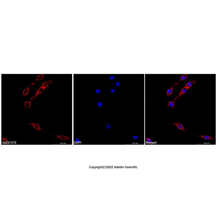 Concanavalin A, AF647 conjugate -   CAS No(11028-71-0) by Aladdin Scientific
